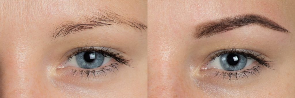 The Before and After of Microblading